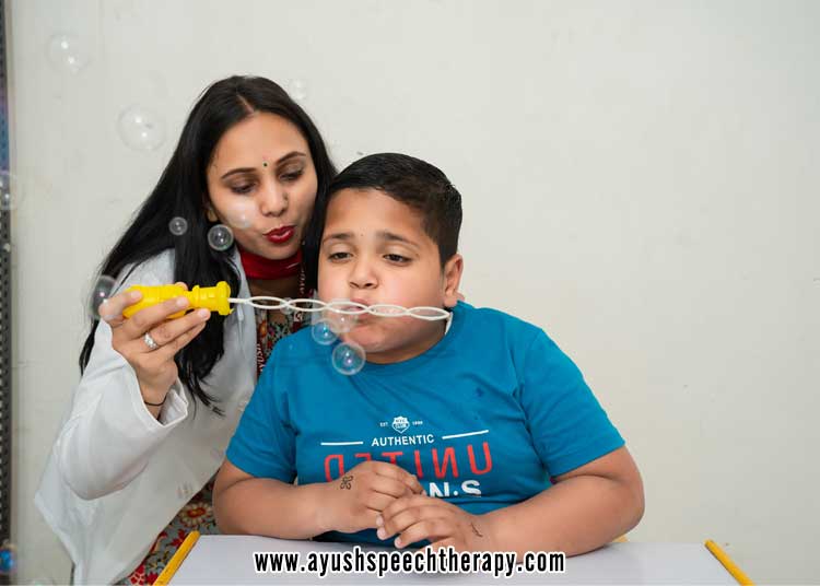 What is a speech language delay ?