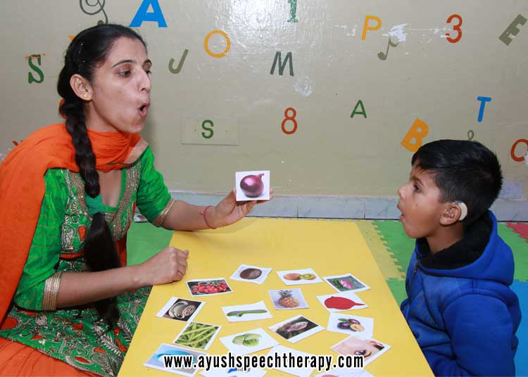 What is a speech language delay ?
